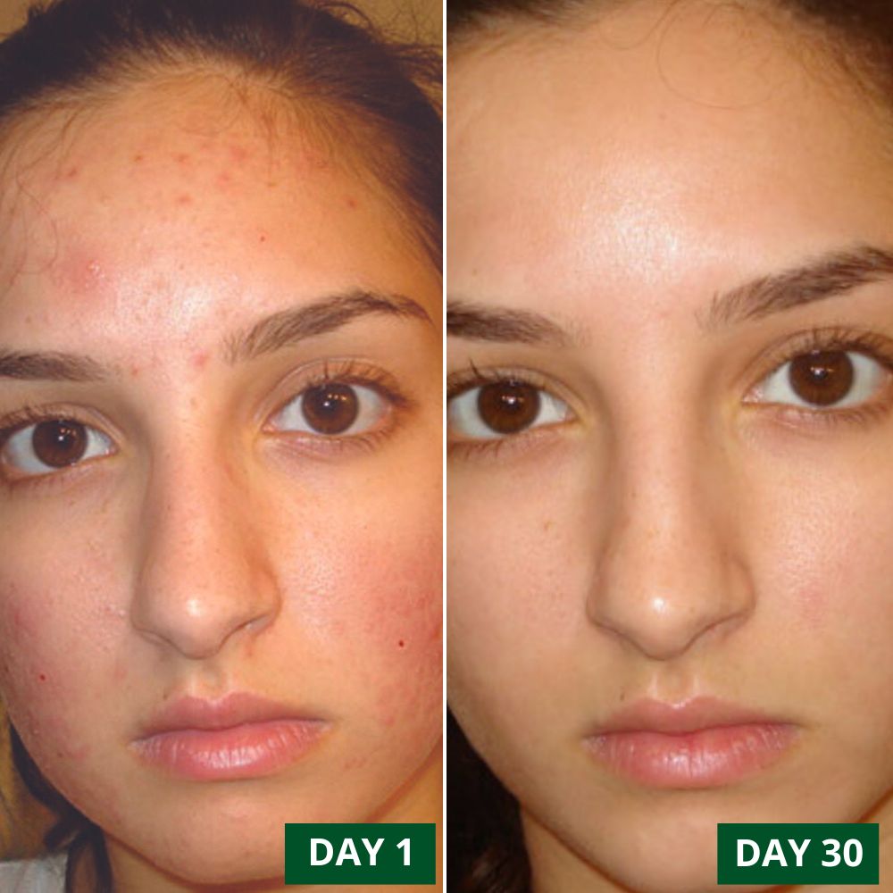 Aabha - Glow Giving Night Time Face Elixir